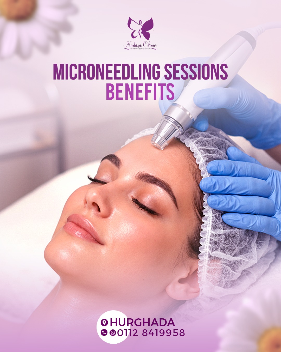 Microneedling sessions for the skin and their benefits in Hurghada